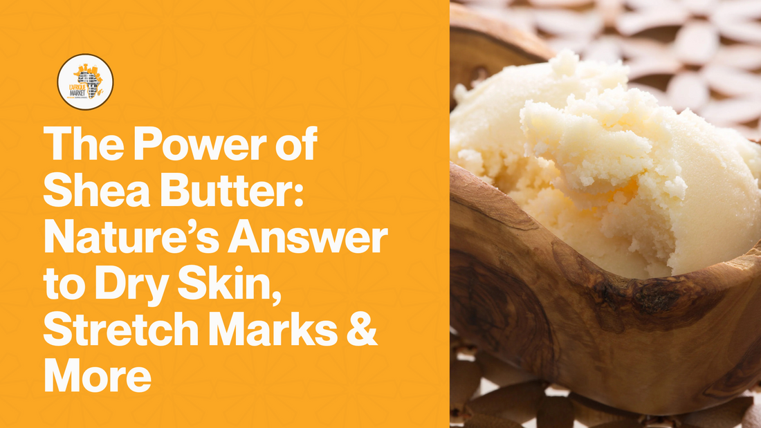 The Power of Shea Butter: Nature’s Answer to Dry Skin, Stretch Marks & More